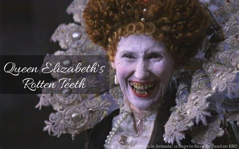 elizabeth's tudors teeth.